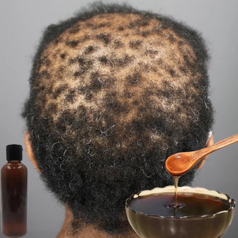 African Miracle Chebe Herbal Growth Shampoo - Natural Solution For Itchy Scalp And Enhanced Hair Nourishment
