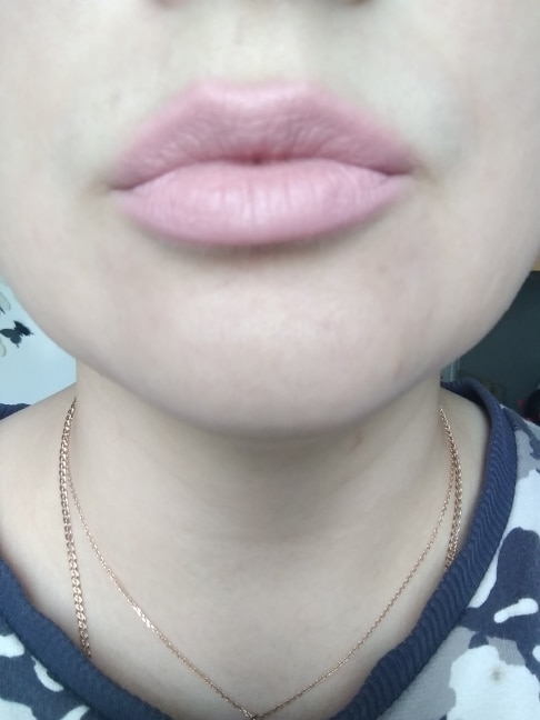 no remark