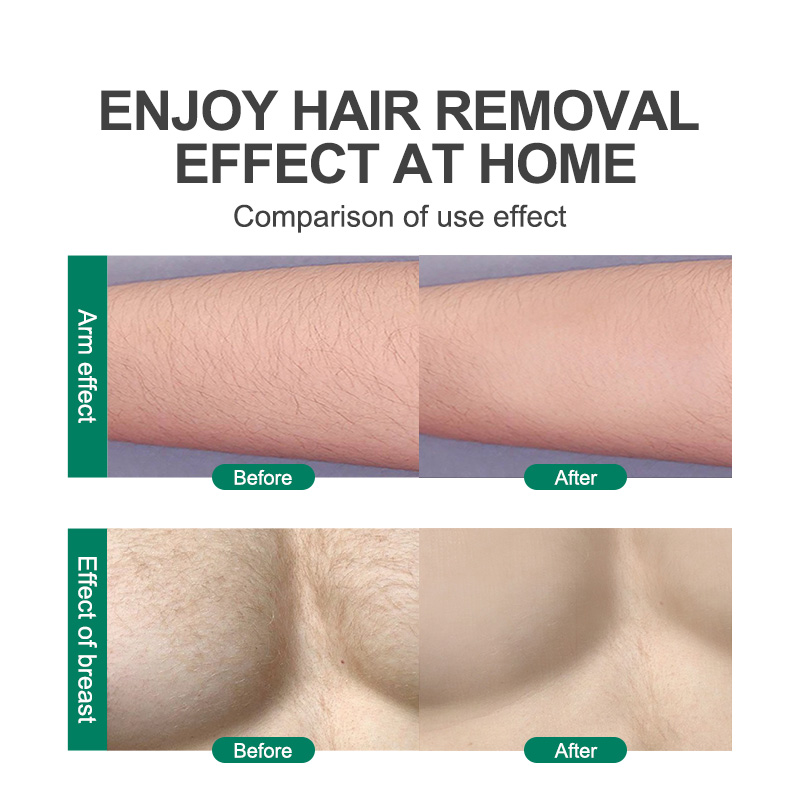 Crystal Hair Eraser: Painless Removal Tool for Women & Men